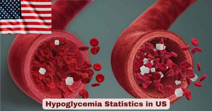 Hypoglycemia Statistics in US