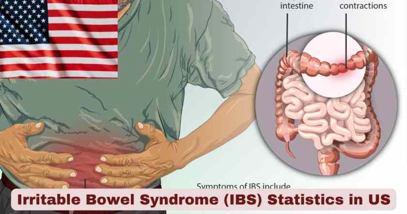 Irritable Bowel Syndrome in US