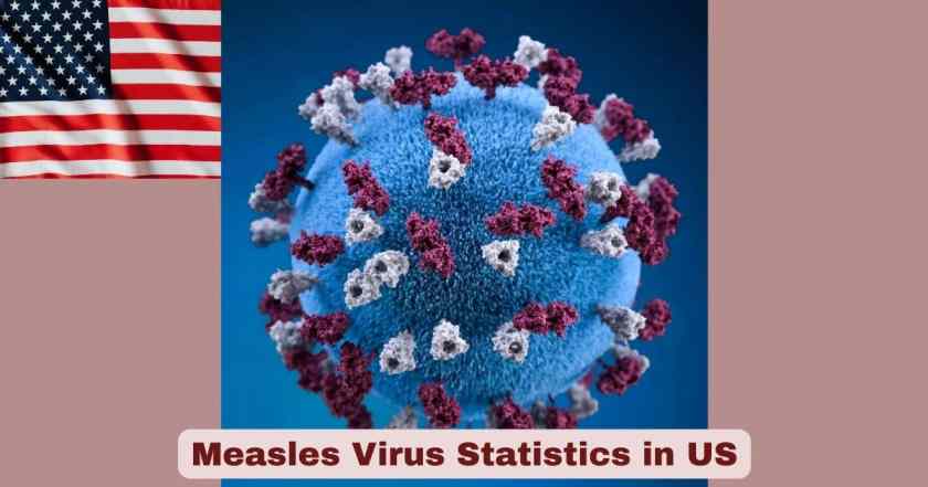 Measles Virus Statistics in US