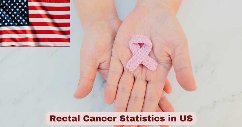 Rectal Cancer in US