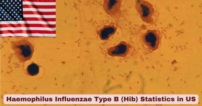 Haemophilus Influenzae Type B (Hib) in US